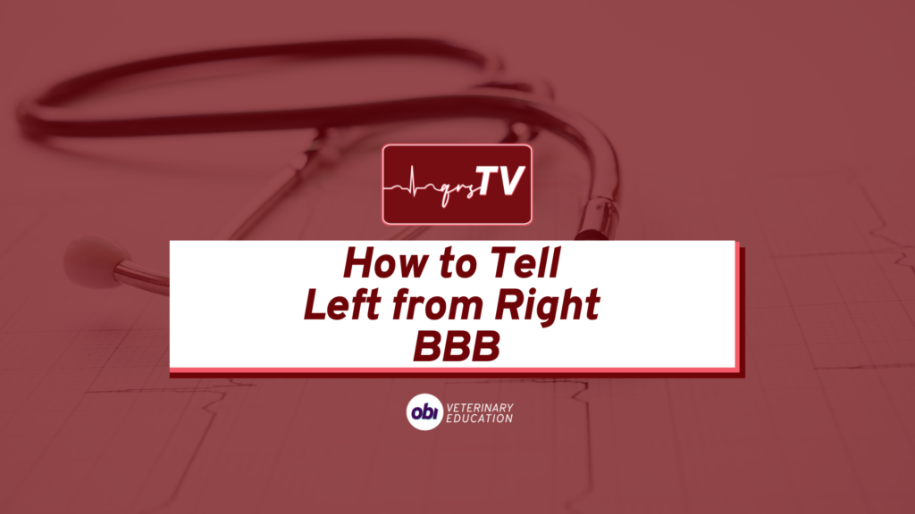 left vs right bundle branch block
