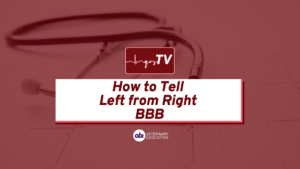 left vs right bundle branch block